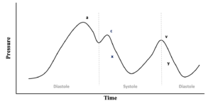 Central Venous Pressure (CVP) - Trauma ICU